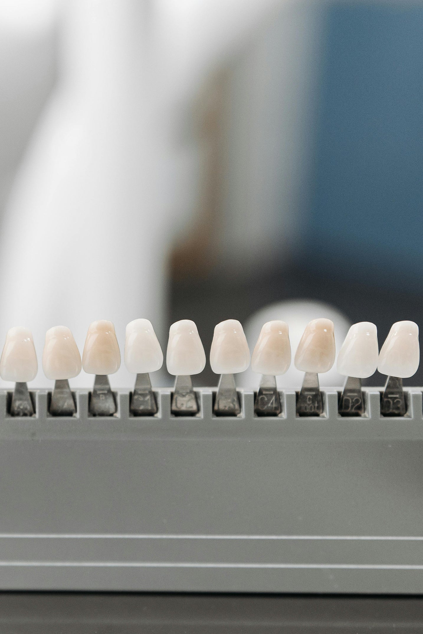 Understanding Tooth Discolouration: What Causes It and How to Fix It!